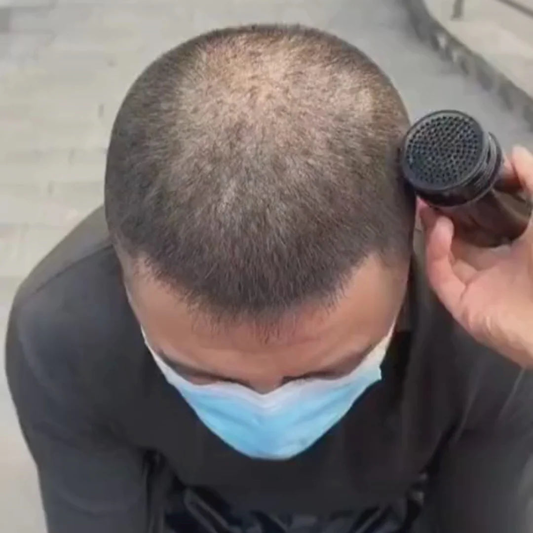 Kit Premium Toppik Cobertura Total + aplicador y un super +🎁 regalo fijador definitivo.